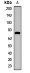 Interleukin 18 Receptor 1 antibody, LS-C668245, Lifespan Biosciences, Western Blot image 