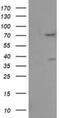 Fragile X Mental Retardation 1 antibody, NBP2-45689, Novus Biologicals, Western Blot image 