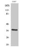 Vascular Endothelial Growth Factor D antibody, STJ96237, St John