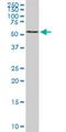 Beta-1,4-N-Acetyl-Galactosaminyltransferase 1 antibody, H00002583-M02, Novus Biologicals, Western Blot image 