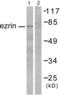 Ezrin antibody, abx013072, Abbexa, Western Blot image 