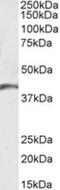 Uracil nucleotide/cysteinyl leukotriene receptor antibody, NBP1-51988, Novus Biologicals, Western Blot image 