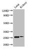 CD9 Molecule antibody, CSB-PA10559A0Rb, Cusabio, Western Blot image 