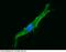Intercellular Adhesion Molecule 1 antibody, 10346-MM01, Sino Biological, Immunohistochemistry frozen image 