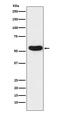 Cholinergic Receptor Nicotinic Alpha 5 Subunit antibody, M02359-1, Boster Biological Technology, Western Blot image 