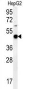 Pyruvate Dehydrogenase E1 Alpha 1 Subunit antibody, abx034458, Abbexa, Western Blot image 