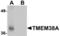 Transmembrane Protein 38A antibody, TA306888, Origene, Western Blot image 