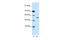 Bromodomain Containing 3 antibody, 28-974, ProSci, Western Blot image 