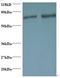 RAB1A, Member RAS Oncogene Family antibody, LS-C210954, Lifespan Biosciences, Western Blot image 