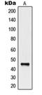 Natural Cytotoxicity Triggering Receptor 1 antibody, orb214899, Biorbyt, Western Blot image 
