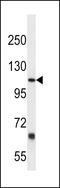 Prostaglandin F2 Receptor Inhibitor antibody, 59-914, ProSci, Western Blot image 