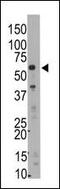 SMYD Family Member 5 antibody, MBS9204925, MyBioSource, Western Blot image 