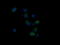 NADH:Ubiquinone Oxidoreductase Subunit B10 antibody, LS-C787432, Lifespan Biosciences, Immunofluorescence image 
