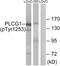 Phospholipase C Gamma 1 antibody, LS-C199473, Lifespan Biosciences, Western Blot image 
