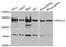 Mtr4 Exosome RNA Helicase antibody, A5576, ABclonal Technology, Western Blot image 