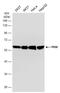 Pyruvate Kinase M1/2 antibody, GTX634796, GeneTex, Western Blot image 