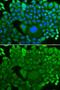 Rho GDP Dissociation Inhibitor Alpha antibody, GTX30064, GeneTex, Immunofluorescence image 