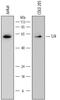 LCK Proto-Oncogene, Src Family Tyrosine Kinase antibody, MAB37041, R&D Systems, Western Blot image 