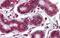 Notch Receptor 4 antibody, PA5-40587, Invitrogen Antibodies, Immunohistochemistry paraffin image 