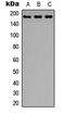 Insulin Receptor Substrate 1 antibody, LS-C368390, Lifespan Biosciences, Western Blot image 