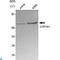Cytochrome P450 Family 7 Subfamily A Member 1 antibody, LS-C812935, Lifespan Biosciences, Western Blot image 