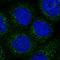Rho GTPase Activating Protein 30 antibody, HPA036300, Atlas Antibodies, Immunocytochemistry image 