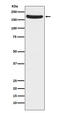 Glutamate Ionotropic Receptor NMDA Type Subunit 2A antibody, M01949-1, Boster Biological Technology, Western Blot image 