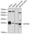 Glutathione S-Transferase Mu 3 antibody, GTX65535, GeneTex, Western Blot image 