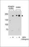 ERBB2 antibody, TA324784, Origene, Western Blot image 