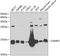 Cellular Retinoic Acid Binding Protein 2 antibody, 22-012, ProSci, Western Blot image 