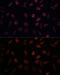 Fatty Acid Binding Protein 1 antibody, GTX32704, GeneTex, Immunofluorescence image 