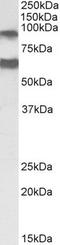 ADAM Metallopeptidase Domain 12 antibody, TA326752, Origene, Western Blot image 