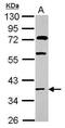 Homeobox C13 antibody, PA5-31019, Invitrogen Antibodies, Western Blot image 