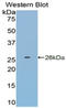 Glutathione S-transferase P 1 antibody, LS-C297953, Lifespan Biosciences, Western Blot image 