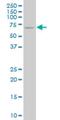 Nuclear receptor coactivator 4 antibody, H00008031-M04, Novus Biologicals, Western Blot image 