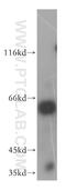 Karyopherin Subunit Alpha 1 antibody, 18137-1-AP, Proteintech Group, Western Blot image 