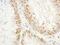 General Transcription Factor IIE Subunit 1 antibody, NBP1-46195, Novus Biologicals, Immunohistochemistry paraffin image 