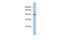 Zinc Finger And BTB Domain Containing 21 antibody, PA5-40588, Invitrogen Antibodies, Western Blot image 