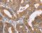 Alcohol Dehydrogenase 1A (Class I), Alpha Polypeptide antibody, MBS2519564, MyBioSource, Immunohistochemistry paraffin image 