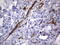 Melanoma Cell Adhesion Molecule antibody, LS-C796883, Lifespan Biosciences, Immunohistochemistry paraffin image 