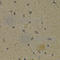 Arachidonate 5-Lipoxygenase antibody, A2158, ABclonal Technology, Immunohistochemistry paraffin image 