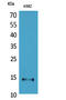 CD59 Molecule (CD59 Blood Group) antibody, STJ96617, St John