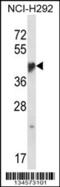 Nuclear Receptor Subfamily 1 Group I Member 3 antibody, 57-837, ProSci, Western Blot image 