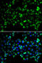 Serine/threonine-protein kinase PINK1, mitochondrial antibody, STJ113137, St John