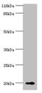 Retinol Binding Protein 5 antibody, orb356363, Biorbyt, Western Blot image 