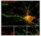 Glutamate Ionotropic Receptor NMDA Type Subunit 2B antibody, NB300-292, Novus Biologicals, Immunohistochemistry paraffin image 