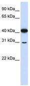 Ovo Like Zinc Finger 2 antibody, TA345332, Origene, Western Blot image 