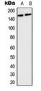 Collagen Type IV Alpha 5 Chain antibody, LS-C353940, Lifespan Biosciences, Western Blot image 