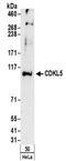 Cyclin Dependent Kinase Like 5 antibody, NBP2-32157, Novus Biologicals, Western Blot image 