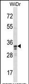 Spi-1 Proto-Oncogene antibody, PA5-35158, Invitrogen Antibodies, Western Blot image 